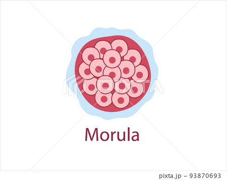 Morula. The Embryo cell of 16 blastomeres in a solid ball contained within the zona pellucida. The Stage of segmentation of a fertilized ovum. Human embryo. Vector medical illustration. Morula. The Embryo cell of 16 blastomeres in a solid ball contained within the zona pellucida. The Stage of segmentation of a fertilized ovum. Human embryo. Vector medical illustration. 93870693
