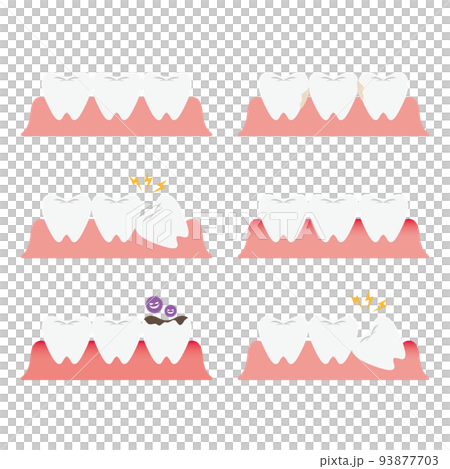 Tooth trouble illustration set Tooth trouble illustration set 93877703
