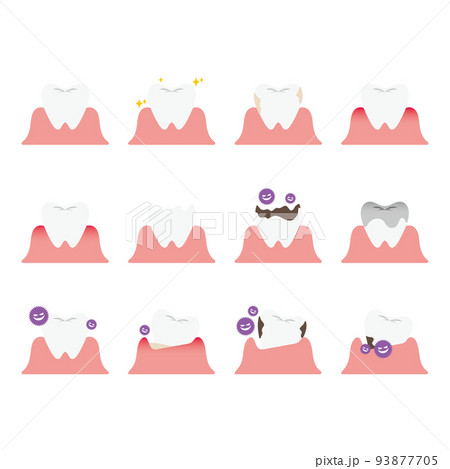 歯のトラブルのイラストセット 93877705
