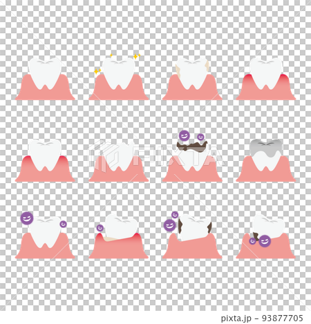 歯のトラブルのイラストセット 93877705