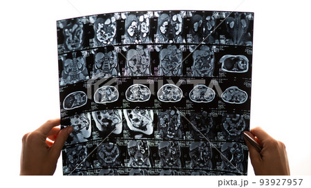 A female doctor examines an MRI scan of the internal organs. Abdomen. A female doctor examines an MRI scan of the internal organs. Abdomen. 93927957