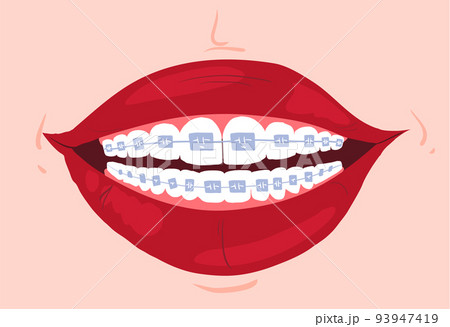 Clean teeth with mouthwash in flat design. Smiling teeth cartoon dental care. Oral healthcare with mouthwash for plaque prevention and fresh breath. 93947419