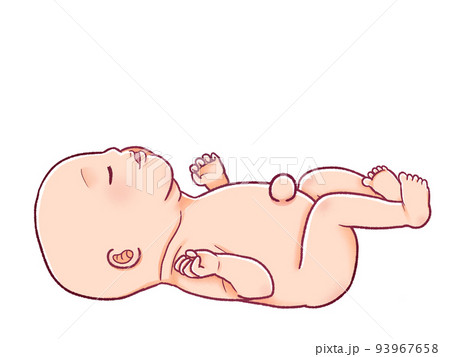臍ヘルニアの赤ちゃんのイラスト素材 臍ヘルニアの赤ちゃんのイラスト素材 93967658