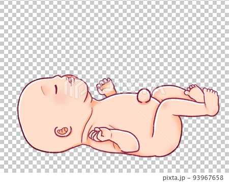 臍ヘルニアの赤ちゃんのイラスト素材 臍ヘルニアの赤ちゃんのイラスト素材 93967658