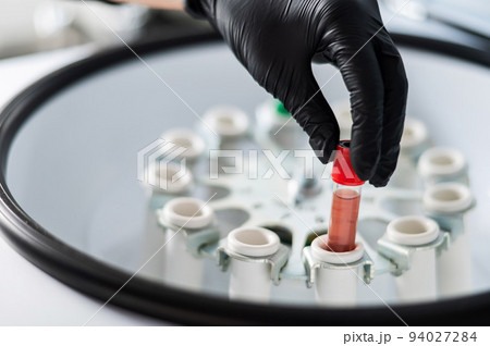 The doctor takes out a test tube with blood plasma from the centrifuge. Plasma lifting procedure for skin rejuvenation. The doctor takes out a test tube with blood plasma from the centrifuge. Plasma lifting procedure for skin rejuvenation. 94027284