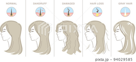 女性の髪の悩み　若い女性の横顔と髪の断面アイコン 94029585