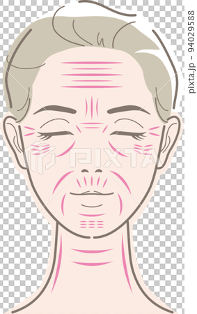 Types of wrinkles on a woman's face Types of wrinkles on a woman's face 94029588