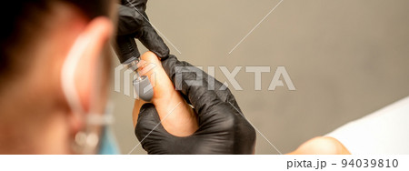 Podiatrist wearing black protective gloves cleaning the skin of foot from callus and corn with the professional electric tool 94039810