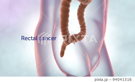 The large intestine includes the colon, rectum and anus. 94041316