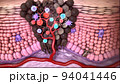 Antibodies destroy an infected cell by a virus, immun defense kill the infected cell 94041446