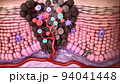 Antibodies destroy an infected cell by a virus, immun defense kill the infected cell 94041448