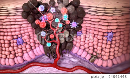 Antibodies destroy an infected cell by a virus, immun defense kill the infected cell Antibodies destroy an infected cell by a virus, immun defense kill the infected cell 94041448