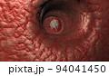 Antibodies destroy an infected cell by a virus, immun defense kill the infected cell 94041450