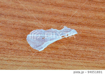Human skin flake after sunburn. Human skin flake after sunburn. 94051891
