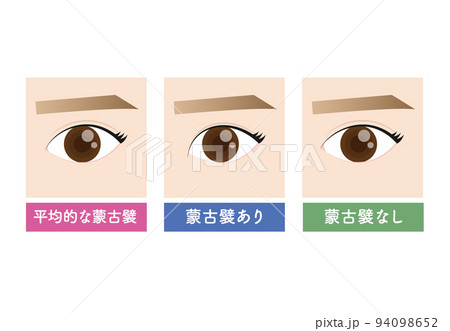 美容整形　蒙古襞の状態 94098652