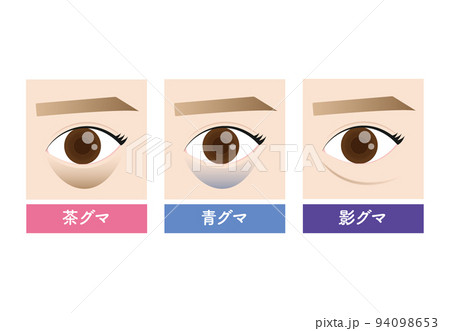 美容　目の下のクマの種類 94098653