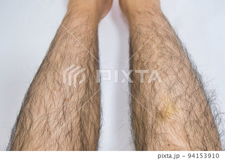 男のすね毛 94153910