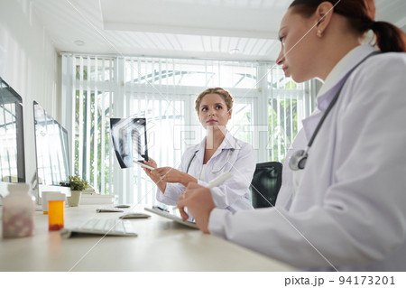 Medical researchers analyzing lungs x-rays of patients who recovered from coronavirus 94173201