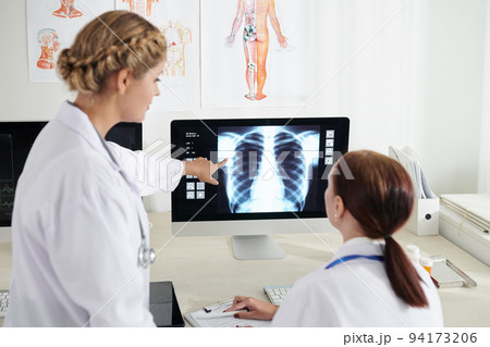 Pulmonologust and surgeon discussing chest x-ray of sick patient on computer screen 94173206