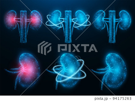 Set of polygonal vector illustrations of inflamed diseased kidney, healthy kidney, and recovery of kidney functions. Internal organ low poly design. Urology or nephrology medical banner, template. 94175263