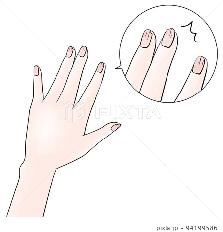 傷んだ爪　水彩風 94199586