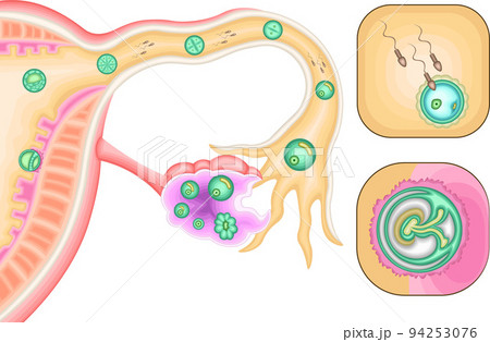 受精 妊娠 イラスト 受精 妊娠 イラスト 94253076