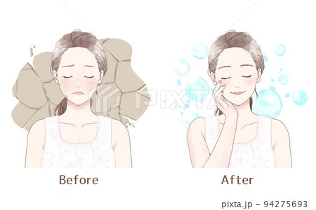 肌乾燥に悩む女性　Before after 94275693
