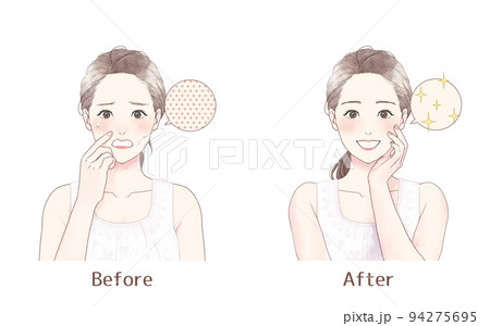 毛穴に悩む女性 Before after 毛穴に悩む女性 Before after 94275695