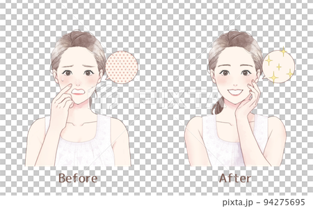 毛穴に悩む女性 Before after 毛穴に悩む女性 Before after 94275695