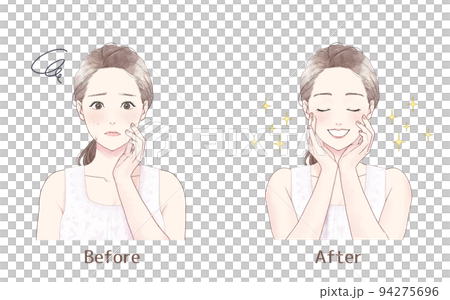 肌荒れに悩む女性 Before after 肌荒れに悩む女性 Before after 94275696