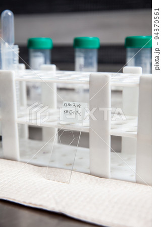 Preparation of slides for karyotipe and fluorescence in situ hybridization - FISH in the laboratory Preparation of slides for karyotipe and fluorescence in situ hybridization - FISH in the laboratory 94370561