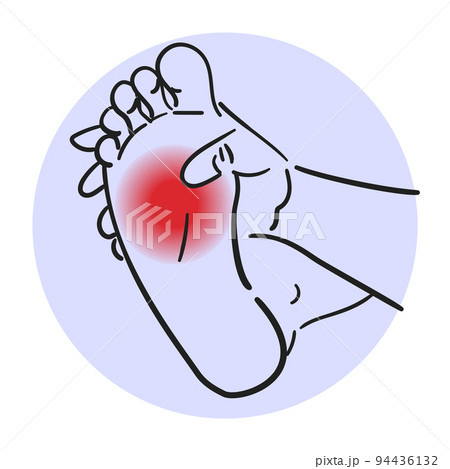 Foot pain vector isolated. Medical illustration, physical injury 94436132
