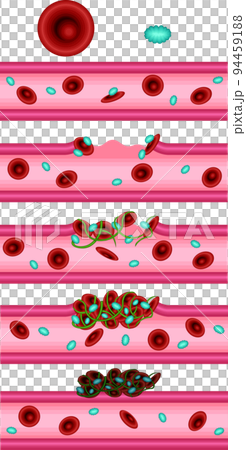 血管凝血機製圖解 94459188