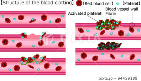 血管凝固の仕組み　英語　イラスト 94459189