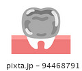 銀歯のイラスト 94468791