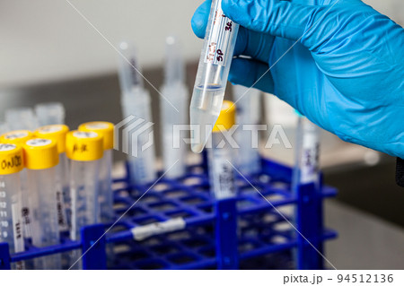 Test tube with blood cells pellet obtained after several washes and centrifugation. Test tube with blood cells pellet obtained after several washes and centrifugation. 94512136