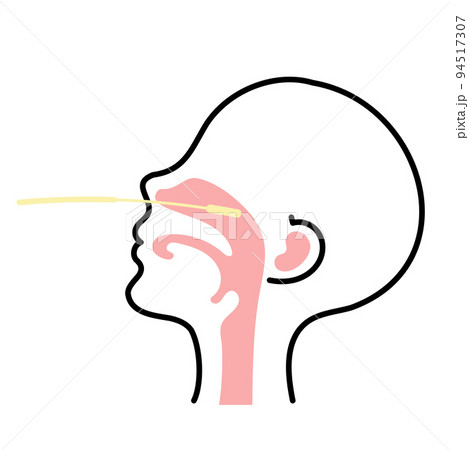 鼻咽頭における検体採取方法 鼻咽頭における検体採取方法 94517307
