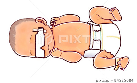 新生児黄疸 光線療法のためにアイマスクをつける赤ちゃん 新生児黄疸 光線療法のためにアイマスクをつける赤ちゃん 94525684