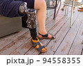 New aluminium prostheses legs for amputee patient. 94558355