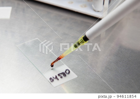 Bone marrow smear preparationin the laboratory. Blood smear preparationin the laboratory. Bone marrow smear preparationin the laboratory. Blood smear preparationin the laboratory. 94611854