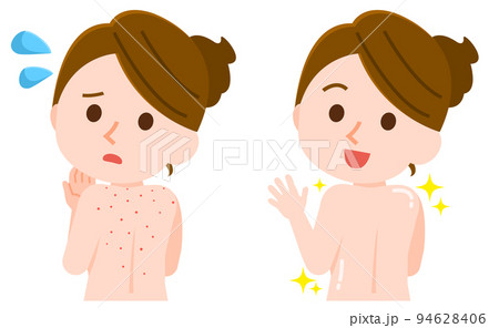 背中ニキビに悩む女性　きれいに治る女性　イラスト 94628406