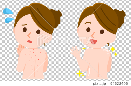 背中ニキビに悩む女性　きれいに治る女性　イラスト 94628406