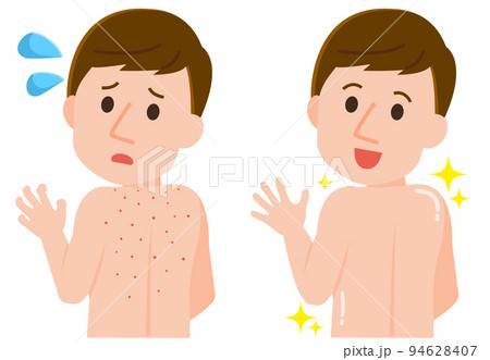 背中ニキビに悩む男性　きれいに治る男性　イラスト 94628407