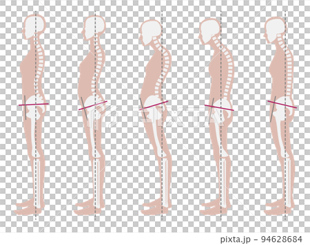 良い姿勢と悪い姿勢の骨格見本 良い姿勢と悪い姿勢の骨格見本 94628684