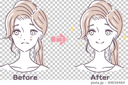 顔のシミに悩む女性のビフォーアフターイラスト素材　しみ　改善　美容 94656464