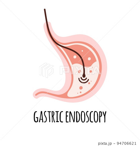 Endoscopy. The stomach of a healthy person. Gastroenterology. Vector illustration in a flat style. 94706621