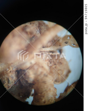 マメ科の植物の根瘤 94719805