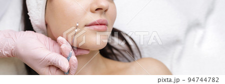 Face lifting PDO Suture operation. innovative technique of New thread lift, cosmetologist preparing to do procedure to female client, select the appropriate thread option 94744782
