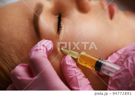 Blood plasma injections in the eye area. 94772891