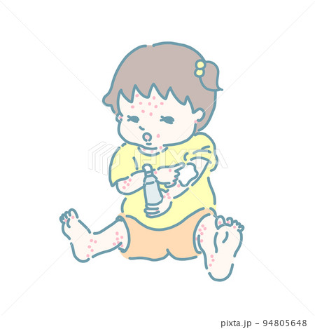 薬を塗るアトピーの女の子(パステルカラー) 薬を塗るアトピーの女の子(パステルカラー) 94805648